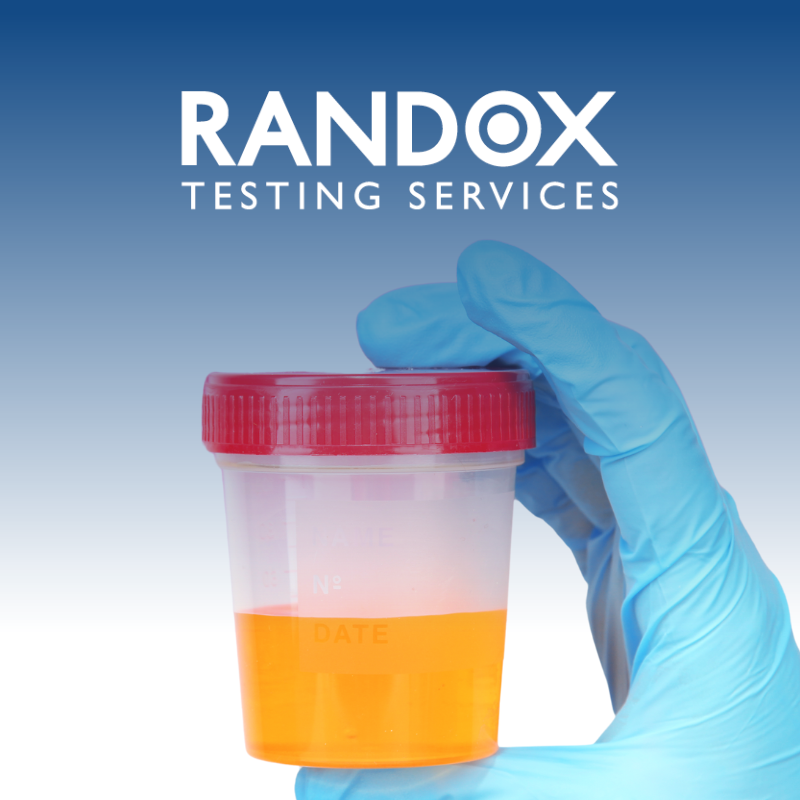 RTS Urine Testing (1)